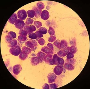 mastocitoma